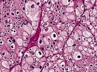 General Pathology