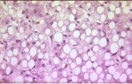 General Pathology