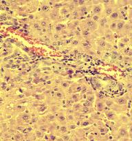General Pathology