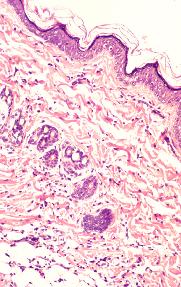 General Pathology
