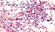 General Pathology