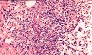 General Pathology