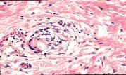 General Pathology