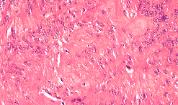 General Pathology