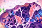 Osteoprosis