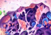 Osteoprosis