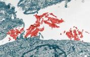 Pharmacology - Image of H1N1 Cells