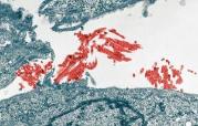 Pharmacology - Image of H1N1 Cells